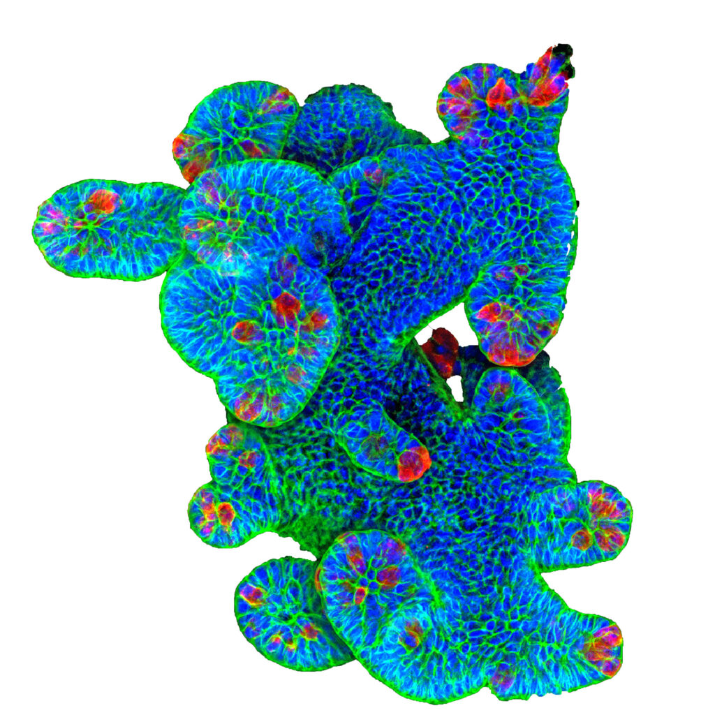 Das Bild zeigt ein Darmorganoid in vitro - Zellkerne blau - Zellmembran-grün - Panethzellen rot weiss