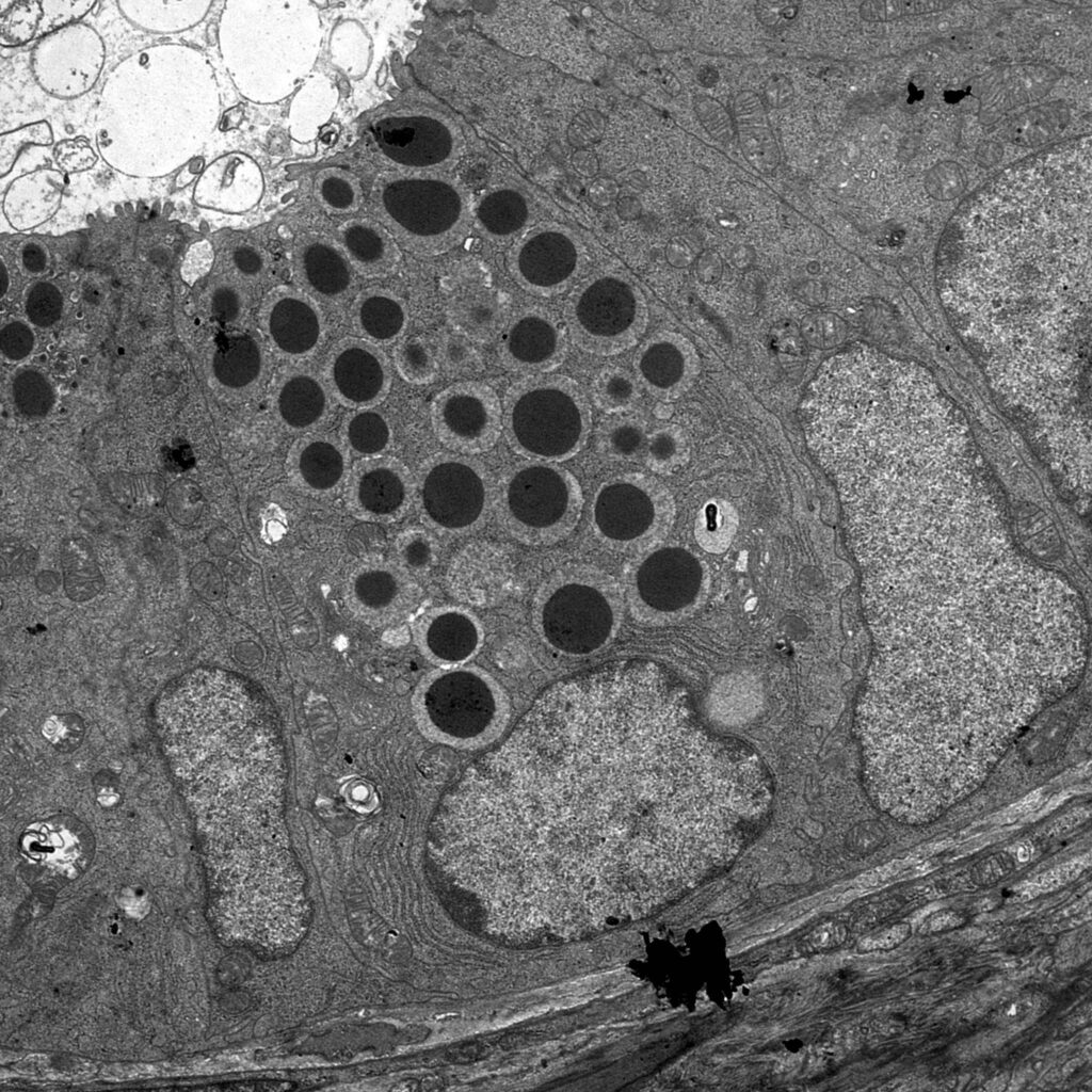 Elektronenmikroskopisches Bild der Darmkrypte mit einer Panethzelle im Zentrum