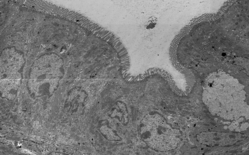 Elektronenmikroskopisches Bild eines Ausschnittes des Darmepithels mit Mikrovilli